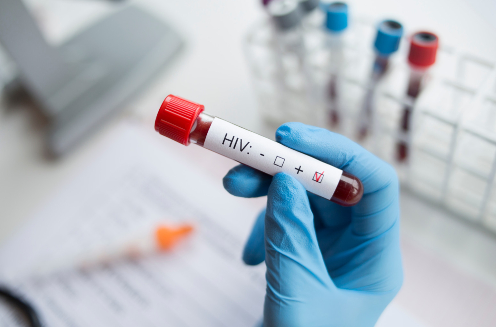 Odobrena vakcina za zaštitu od HIV-a: "Ovo menja pravila igre"