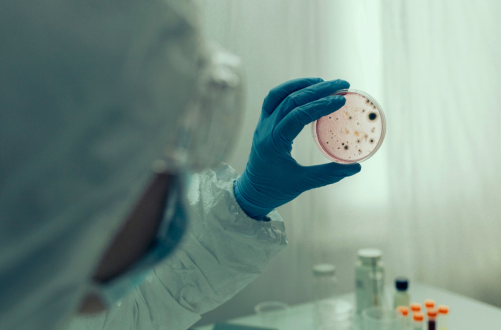 Izbila epidemija kolere: Umrlo 58 ljudi