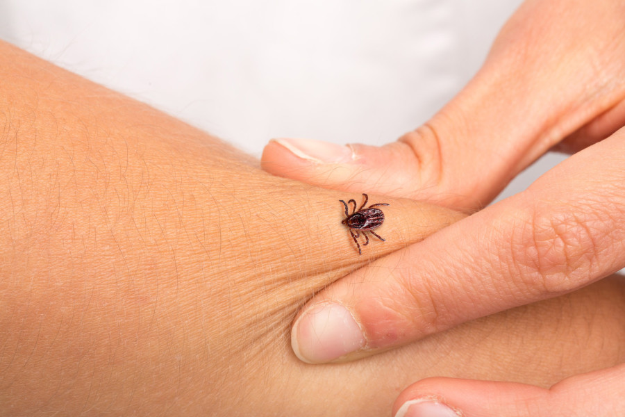 Doktorka savetuje: Jednu stvar nikako nemojte da radite kada primetite krpelja