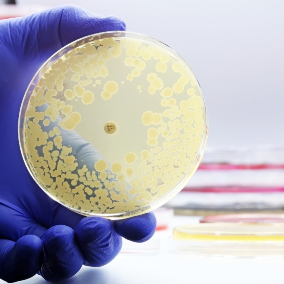 Gori nego što se mislilo: Dejstvo antibiotika štetno i do osam godina