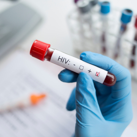 Svetski dan borbe protiv HIV-a: Danas besplatno testiranje i savetovanje