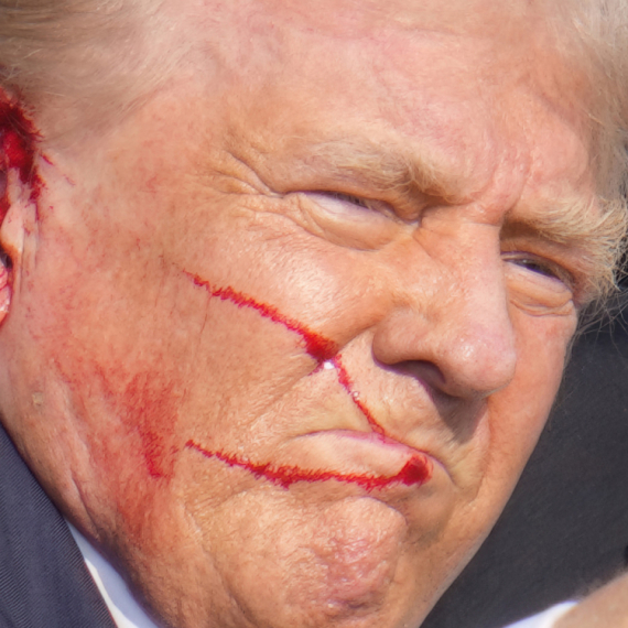 Shock; FBI director: I doubt Trump was hit by a bullet