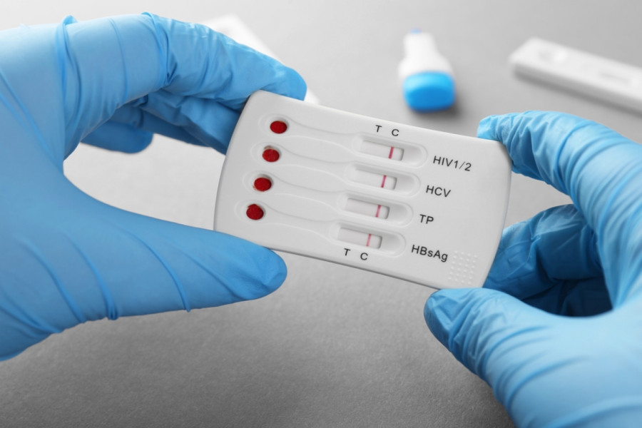 Nemački naučnici otkrili antitelo protiv HIV-a