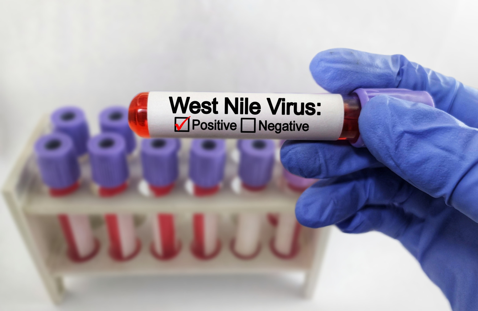 Oprez ako letujete u Grčkoj: Širi se opasan virus, sve više novih slučajeva