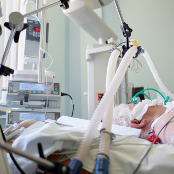 410 obolelih od tuberkuloze u Srbiji za godinu dana: Evo kako da prepoznate simptome