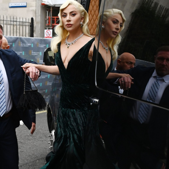 Lejdi Gaga ispod bizarnih kostima krije seksi obline – i obožava da nosi bikini FOTO