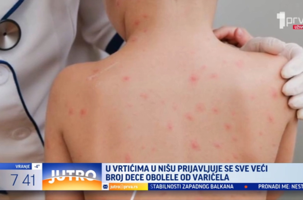 Vrtićka deca na udaru: "Prvo krene od lošeg opšteg stanja" VIDEO