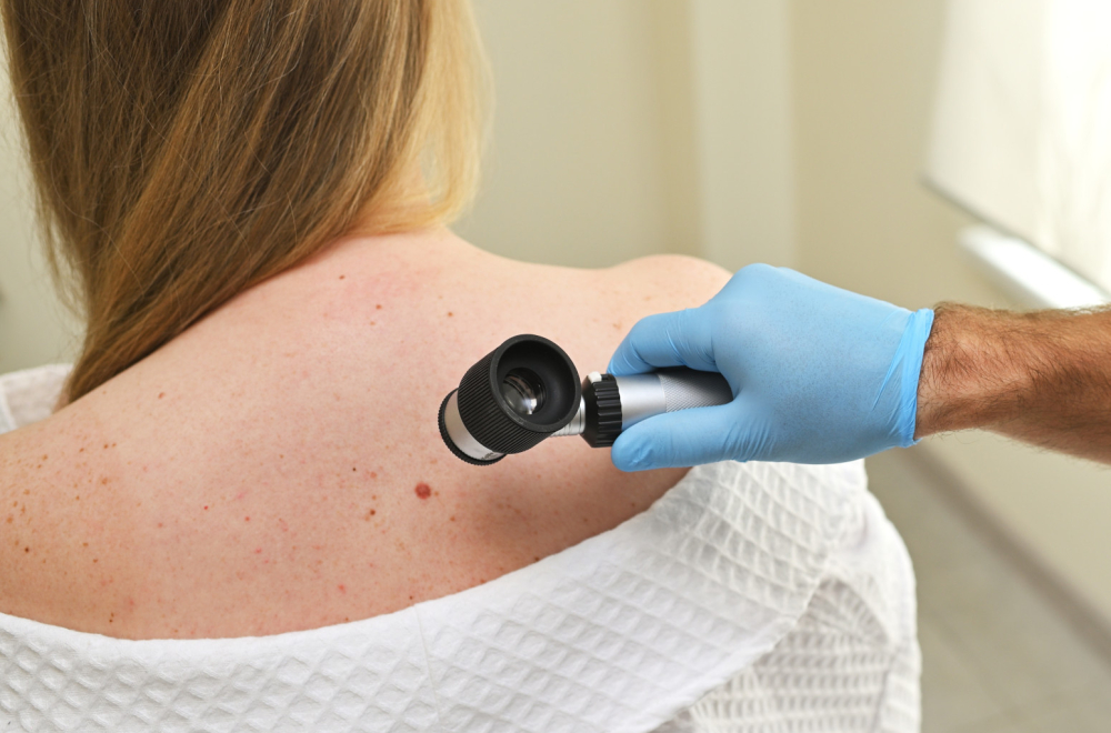 Dermatolog upozorava na jednu stvar, naročito tokom leta: "Odmah se javite lekaru" VIDEO