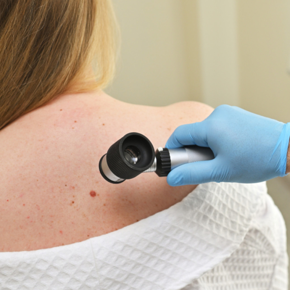 Dermatolog upozorava na jednu stvar, naročito tokom leta: "Odmah se javite lekaru" VIDEO