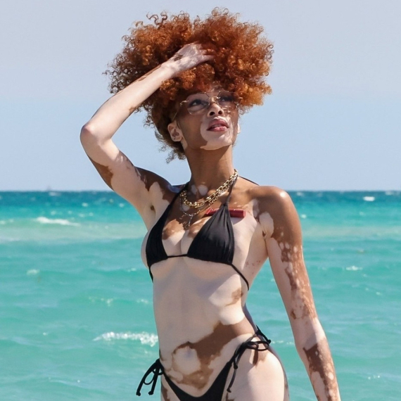 Najpoželjnija manekenka trpela jezive uvrede zbog izgleda, fotkama u bikiniju svima zapušila usta FOTO