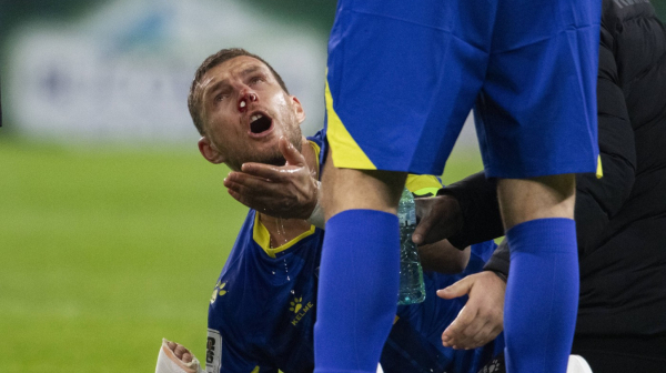 Da li je Edin Džeko fudbaler?! Objavio je jezive fotografije FOTO