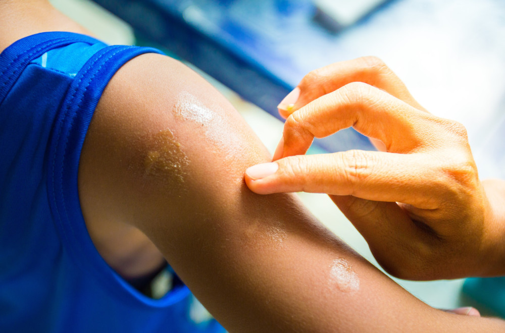 Evo koje simptome izaziva virus koji se širi svetom: Ove grupe ljudi su najugroženije