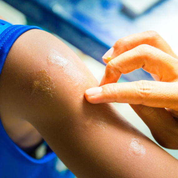 Evo koje simptome izaziva virus koji se širi svetom: Ove grupe ljudi su najugroženije