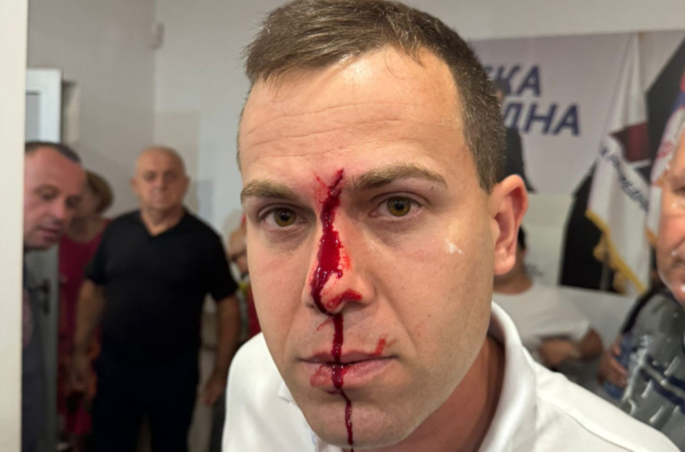 Povređena tri člana SNS: Oglasio se Opštinski odbor u Lazarevcu povodom jezivog nasilja blokadera