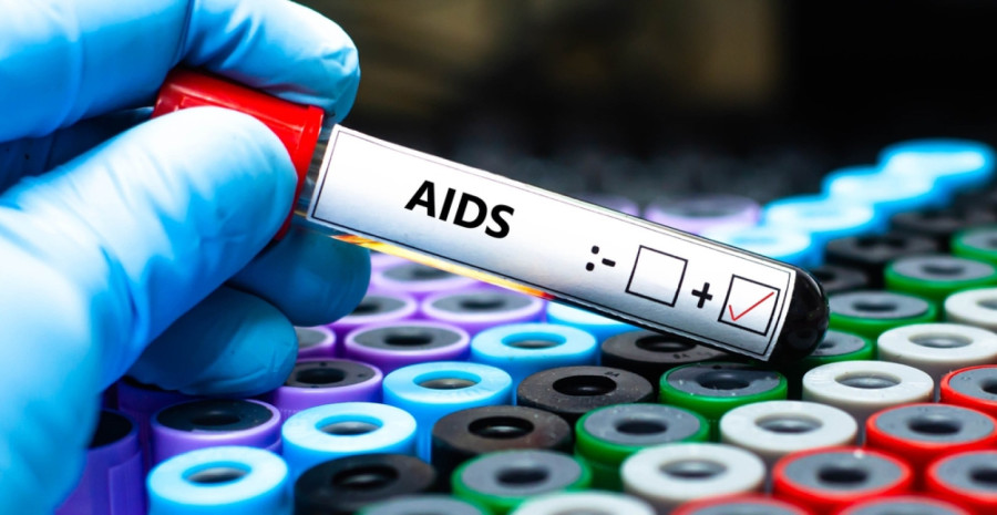 Nemački naučnici otkrili antitelo protiv HIV-a