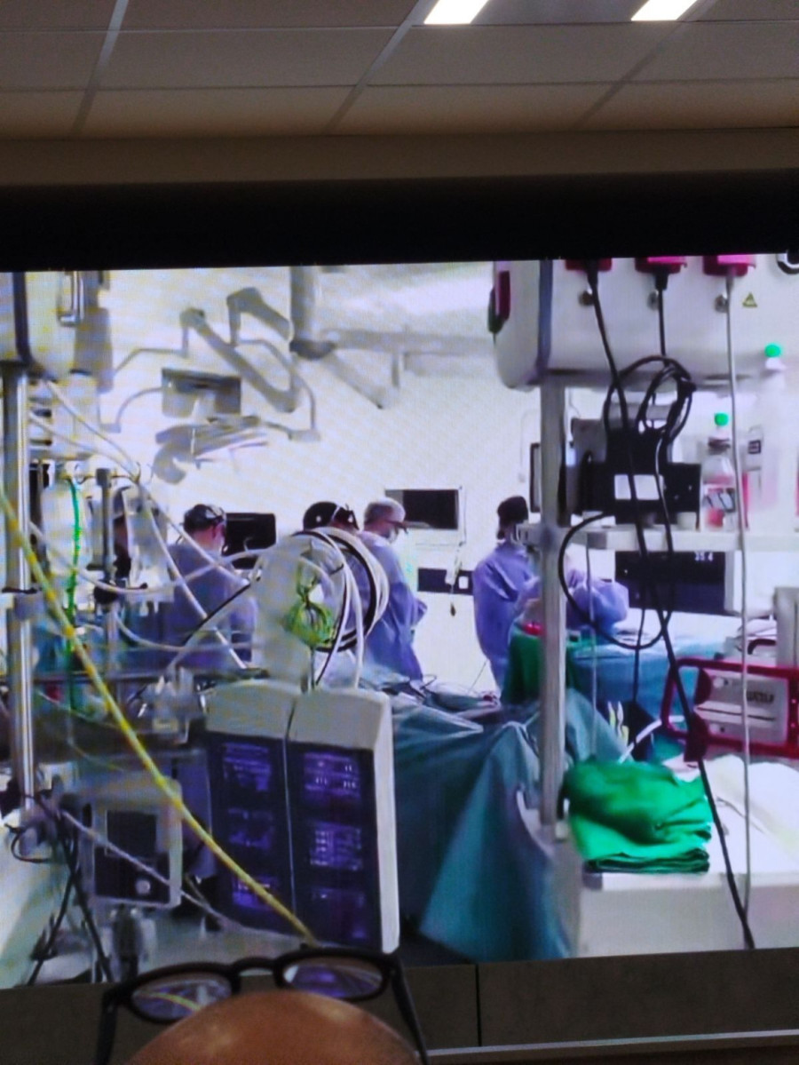 Prvi put na Balkanu: U Srbiji urađena operacija na srcu uz pomoć robota; Bez krvarenja i trauma FOTO