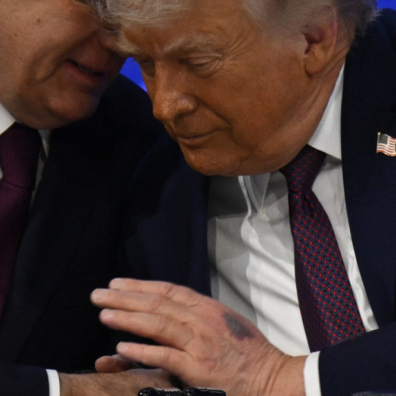 Trampove modrice glavna tema i u Davosu : "Udario je o ivicu stola" FOTO