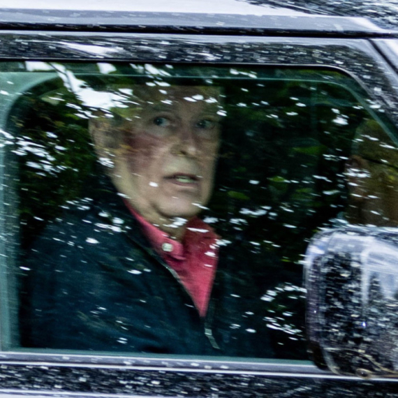 Šok u Britaniji: Bivši princ se pojavio sa ogromnom modricom na licu FOTO