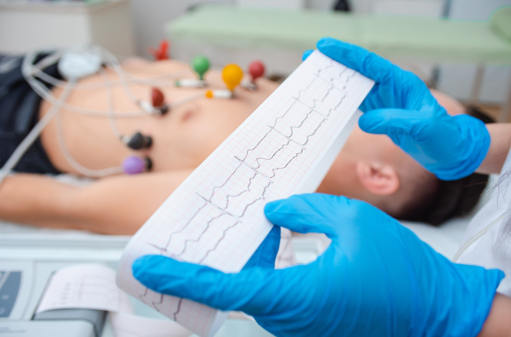 Šta je EKG i kako se pripremiti za pregled?