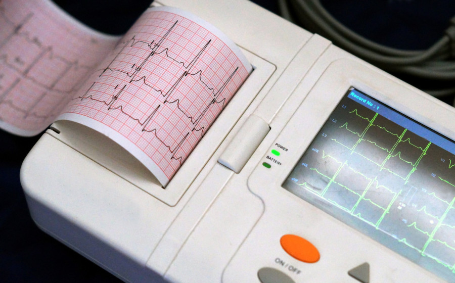 Šta je EKG i kako se pripremiti za pregled?
