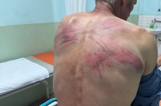 Jezivo nasilje: Tzv. kosovska policija pretukla Srbina; Hitno se oglasila Srpska lista FOTO