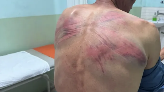 Priznanje u Prištini; Ovo je dokaz da su Kurtijevi policajci tukli i zlostavljali Nenada Raškovića
