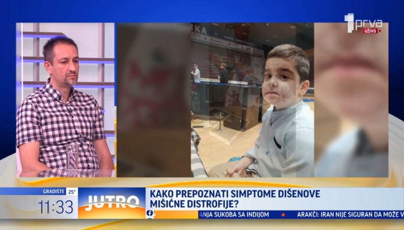 Petorici dečaka potrebna terapija za Dišenovu mišićnu distrofiju