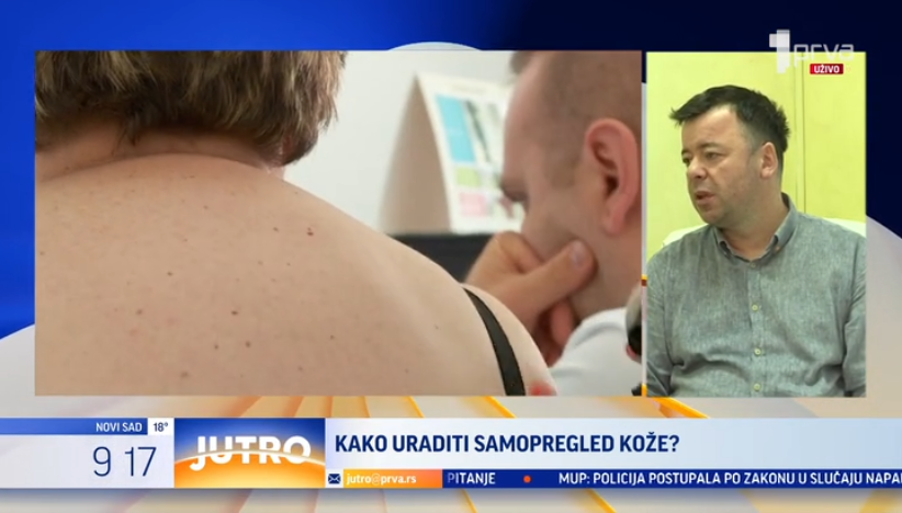 Kako se vrši samopregled kože?