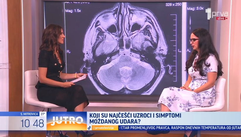 Koji su simptomi i uzroci moždanog udara?